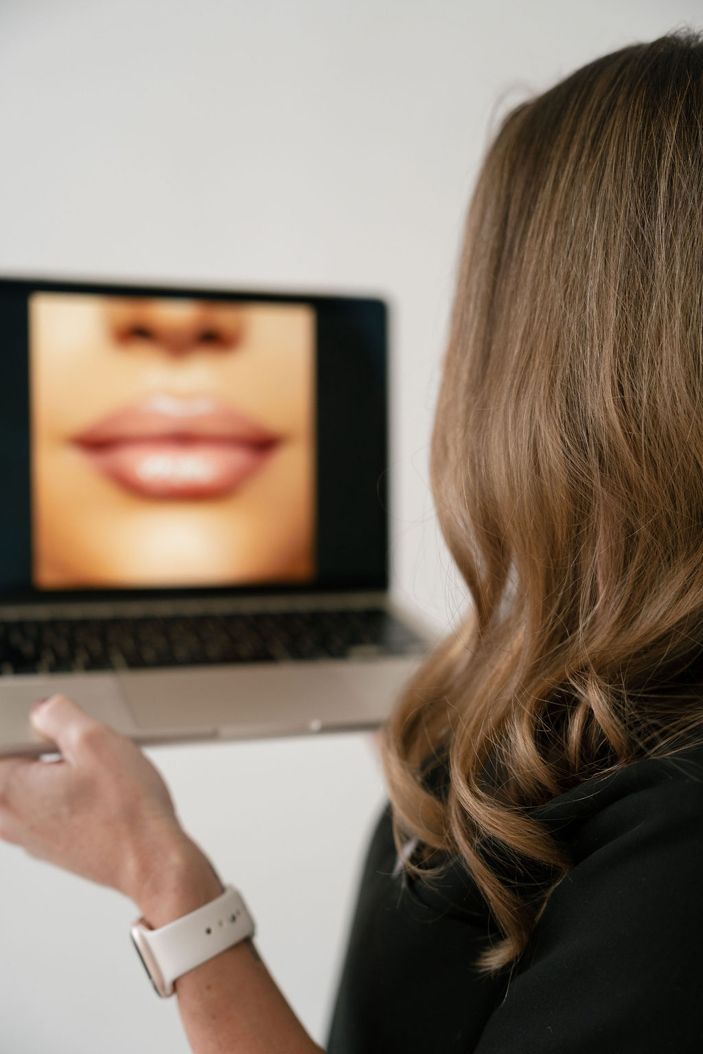 Featured image for Lip Fillers